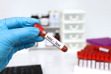 HAV Test to look for abnormalities from blood