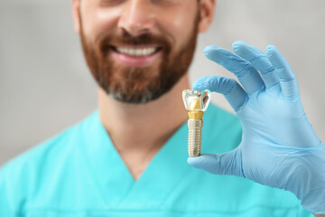 Dentist holding educational model of dental implant on blurred background, closeup