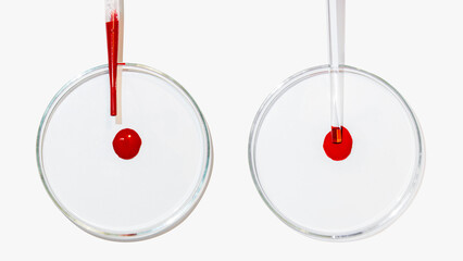 Several petri dishes on a light background. A drop of blood. Laboratory test, dna, blood test, laboratory.
