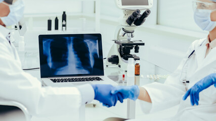 x-ray of the lungs on a laptop screen in the lab