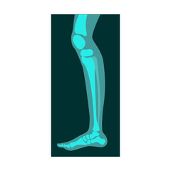 Ray of human leg vector illustration. Bones of skeleton, roentgen, radiography isolated on white background. Anatomy, medicine, health concept