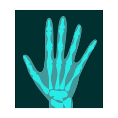 Fototapeta na wymiar Ray of human hand top view vector illustration. Bones of skeleton, roentgen, radiography isolated on white background. Anatomy, medicine, health concept