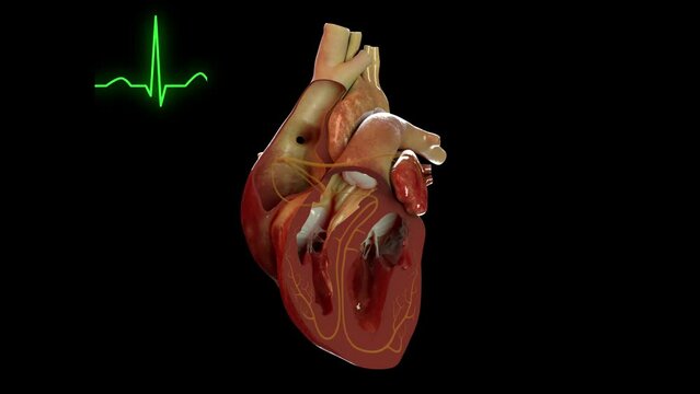 Human heart showing electrical activity in sync with and EGC (EKG)