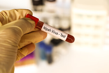 Nipah virus test to look for abnormalities from blood