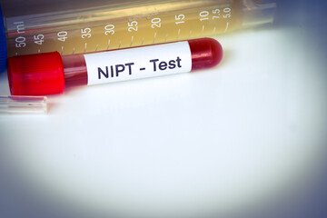 NIPT test to look for abnormalities from blood