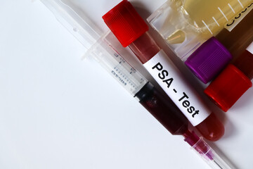 PSA test to look for abnormalities from blood
