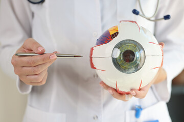Ophthalmologist doctor holds part of anatomical model of eye close up.