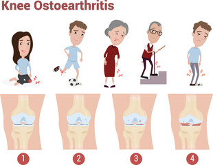 Knee Osteoarthritis infographic to explain about pain, knee pain, joint pain which happen in adult and elder health