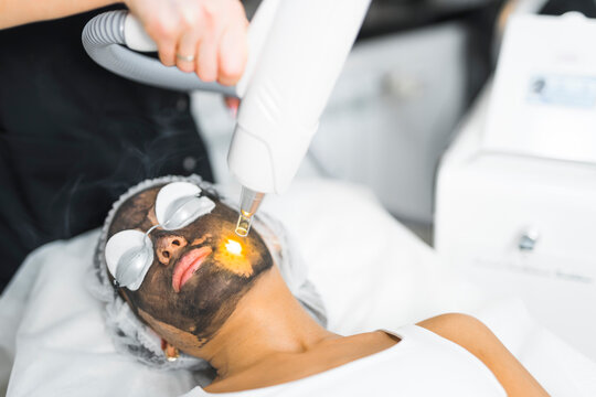 young woman with black face mask having laser complexion cleaning at the spa, skincare concept medium closeup. High quality photo