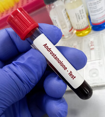 Test tube with blood sample for Androstanolone or Dihydrotestosterone(DHT) hormone test.
