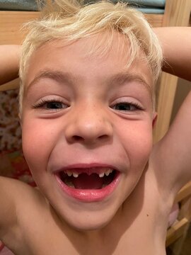 young boy showing off teeth missing