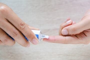 The woman's hand, she uses steroids Apply External type