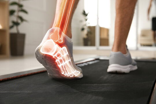 Digital composite of highlighted bones and man training on walking treadmill at home, closeup