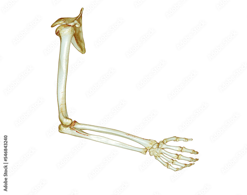 Poster ct scan of arm 3d rendering isolated on white background .clipping path.