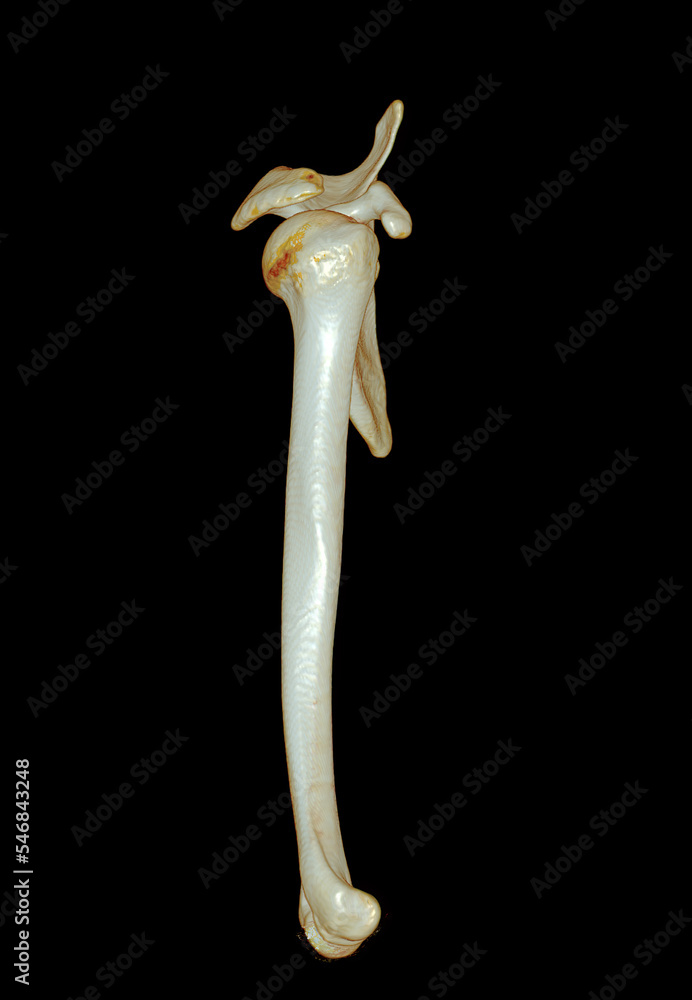 Poster ct scan of arm 3d rendering isolated on black background .