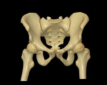 CT scan of Pelvic bone and hip joint 3D rendering for diagnosis fracture of Pelvic bone and hip joint isolated on black background.