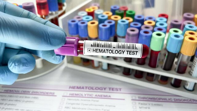 Technician lab with Blood testing over requisition report for Hematology test. Doctor holding Blood sample tube for analysis in Hematology laboratory