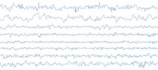 Cardiogram vector background.Heartbeat Cardiogram.Heartbeat line