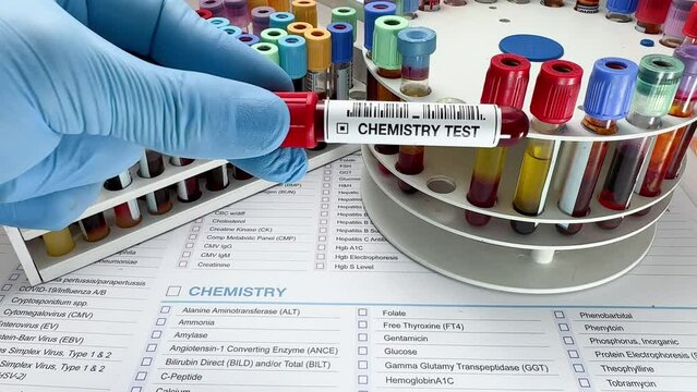Doctor holding Blood sample tube for analysis of blood chemistry study in the laboratory. Technician lab with Blood testing over requisition report for blood chemistry test