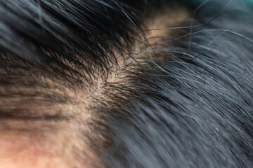 close up selective focus of man black hair on head