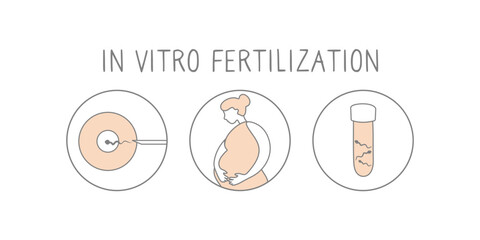 In vitro fertilization icon set. Linear simple illustration pregnancy and fertility. IVF fertilization signs. Vector