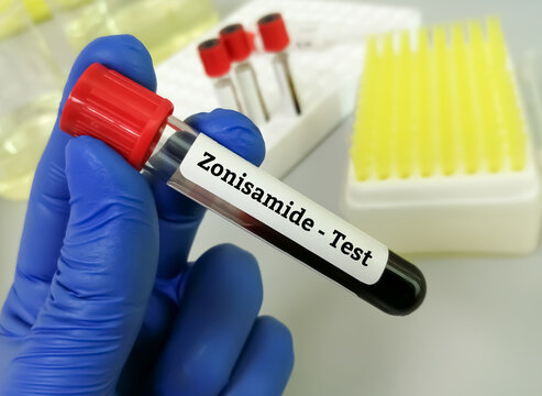 Blood sample for Zonisamide blood test, to maintain a therapeutic index, medical concepts