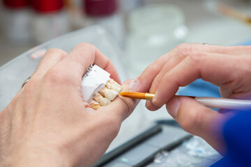 Manufacturing of dentures. Dental technician fixing a denture