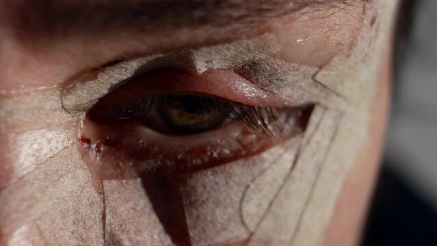 macro female eye after blepharoplasty surgery correction of sagging eyelid skin
