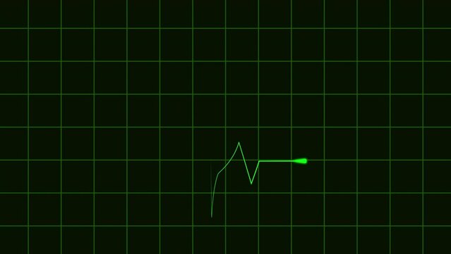 Heart rate monitor EKG line shows heartbeat with a graph of heart rhythm on black background.