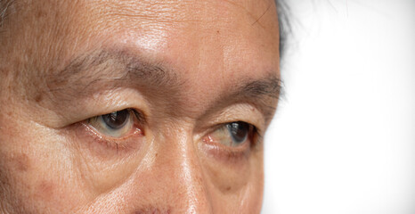 Skin creases around the eye of Asian elder man