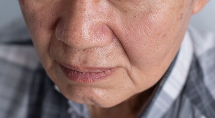 Enlarged pores in face of Asian, elder man with skin folds.
