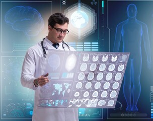 Male doctor studying results of brain mri scan