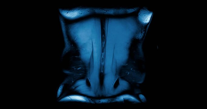 Medical scan showing human body part while scanning