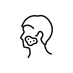 Rosacea black line icon. Dermatology disease.