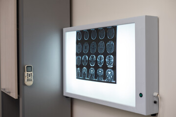 In Medical Laboratory Patient Undergoes MRI or CT Scan Process under Supervision of Doctor and...