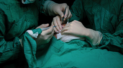 Doctor and nurse medical team are performing surgical operation at emergency room in hospital.