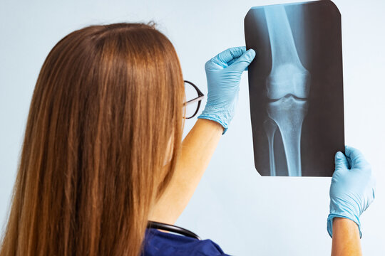 Female doctor examining xray image diagnosing injury on blue background