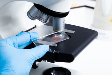 microscope blood sample at the medicine and medical laboratory