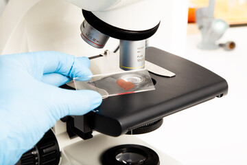 microscope blood sample at the medicine and medical laboratory