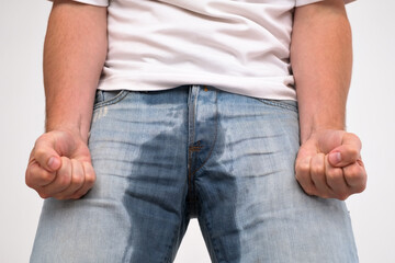 Man with prostate complication have problem with urinary incontinence.