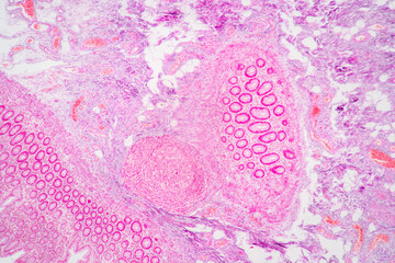 Backgrounds of Characteristics Tissue of Stomach Human, Small intestine Human, Pancreas Human and...