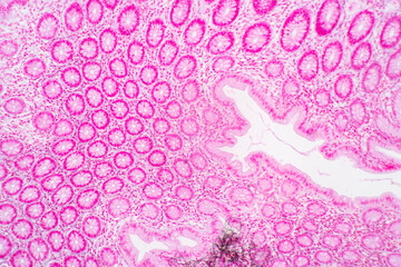 Backgrounds of Characteristics Tissue of Stomach Human, Small intestine Human, Pancreas Human and Large intestine Human under the microscope in Lab.