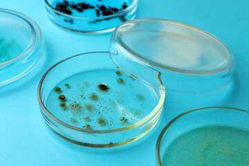 Petri dishes with different bacteria colonies on light blue background, closeup