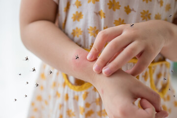 Little girl has skin rash allergy and itchy on her arm from mosquito bite
