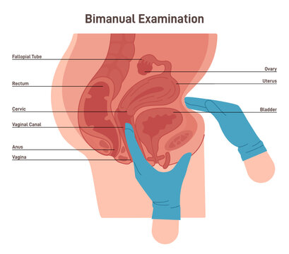 Bimanual examination. Gynecologist check-up. Female pelvic examination