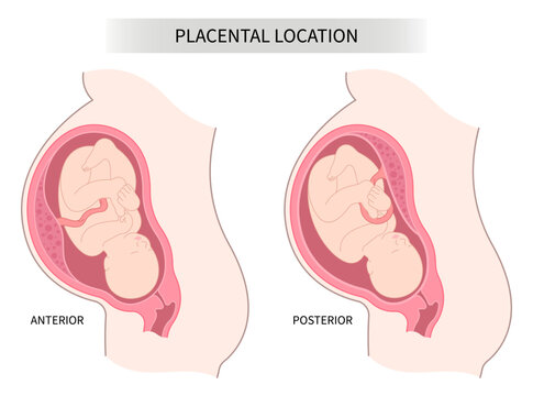 Lateral baby placenta location of pregnancy back fetus Labour death uterine wall intrauterine gender prediction growth restriction prenatal care