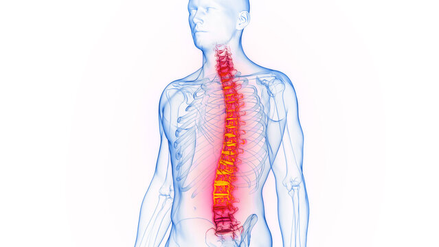 3D rendered Medical Illustration of Male Anatomy - Inflamed Spine.