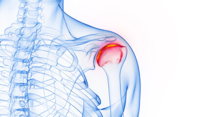 3D rendered Medical Illustration of Male Anatomy - Inflamed Shoulder Joint. - 547989041