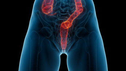 3D Rendered Medical Illustration of Female Anatomy - the rectum. - obrazy, fototapety, plakaty