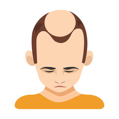 Four stage of alopecia in men vector illustration. Top of male head with bald spot on scalp isolated on white background. Health, hair loss or treatment concept
